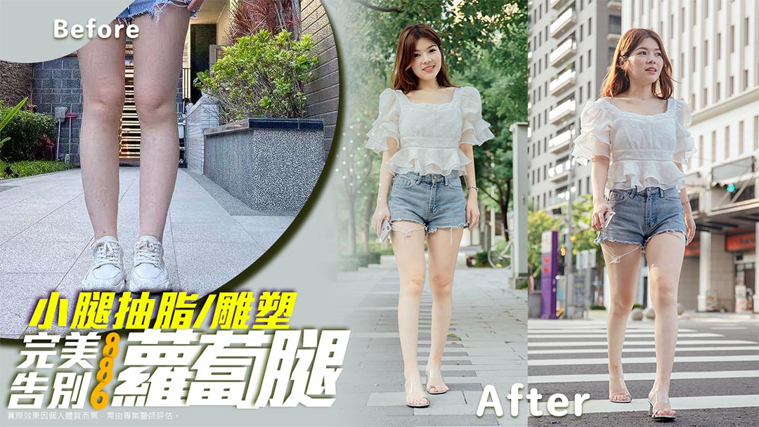 周爾康整形外科診所